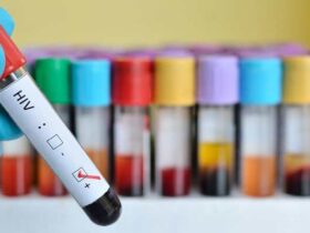 کمپین «من هم آزمایش اچ‌آی‌وی می‌گیرم» از امروز تا 30 آذرماه آغاز می‌شود