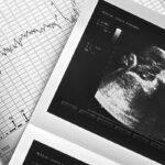 غربالگری در کشور ممنوع نیست و همچنان انجام می شود