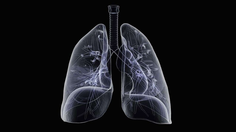 ذات الریه چیست؟ | علائم، علل و روش های درمانی برای پیشگیری و بهبودی سریع 4 ذات الریه چیست؟ | علائم، علل و روش های درمانی برای پیشگیری و بهبودی سریع