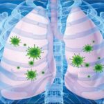 ذات الریه چیست؟ | علائم، علل و روش های درمانی برای پیشگیری و بهبودی سریع