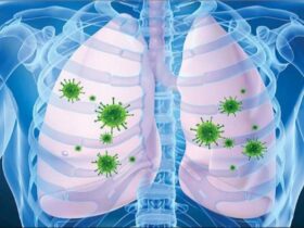 ذات الریه چیست؟ | علائم، علل و روش های درمانی برای پیشگیری و بهبودی سریع 8 ذات الریه چیست؟ | علائم، علل و روش های درمانی برای پیشگیری و بهبودی سریع