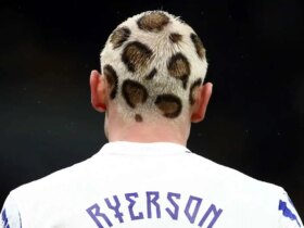 عکس؛ مدافع مدل موی پلنگی تیم ملی نروژ 8 عکس؛ مدافع مدل موی پلنگی تیم ملی نروژ