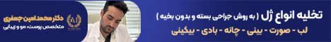 دکتر امین جعفری – تصادفی چسبنده