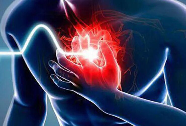 حمله قلبی: علائم، علل و روش های پیشگیری از حمله قلبی چگونه حمله قلبی را تشخیص دهیم؟