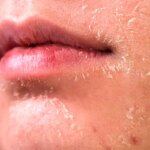 5 روش برای مراقبت از پوست در زمستان