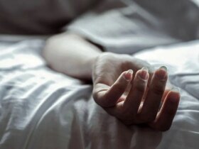 بدن زن جوان پس از تزریق ژل بی کیفیت سوخت