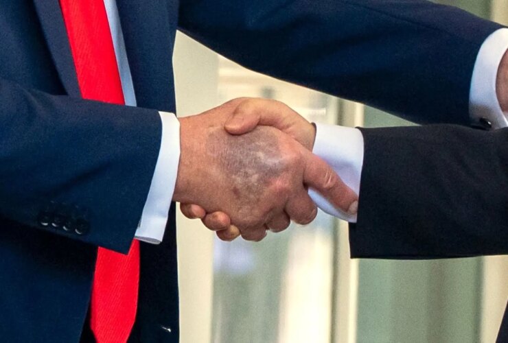 ترامپ سعی می کند کبودی مزمن دست راست خود را پنهان کند