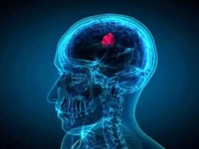 قطره های بینی که تومورهای کشنده مغز را کوچک می کند 8 قطره های بینی که تومورهای کشنده مغز را کوچک می کند