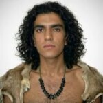 بازسازی صورت