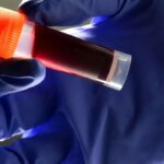 گروه خونی که بیشترین سکته های مغزی را ایجاد می کند!