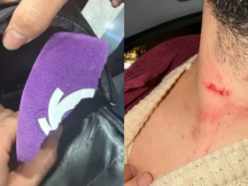 ماجرای حمله به خبرنگاران و دخالت پلیس به دستور محمود فکری! 9 حمله کنند