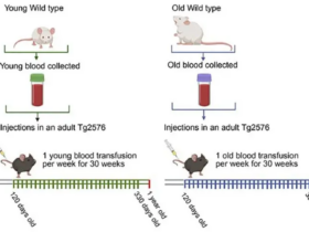پیری مغز باعث آلزایمر می شود! 10 آلزایمر