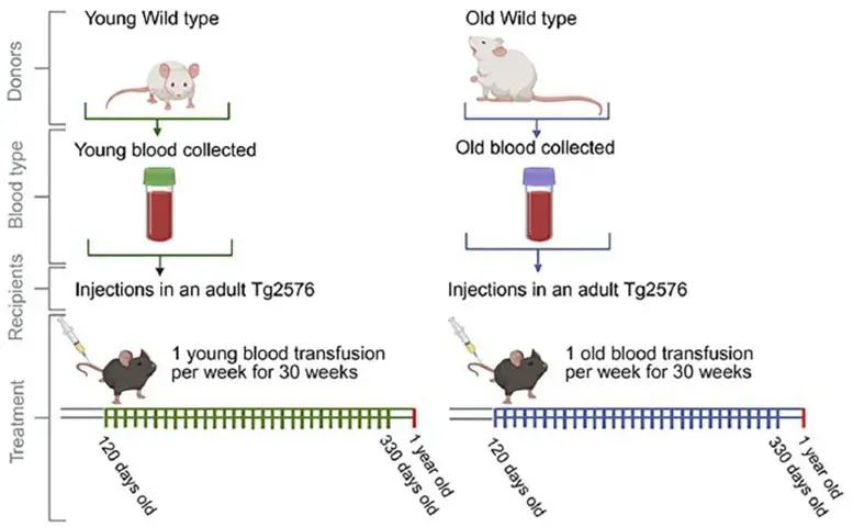 پیری مغز باعث آلزایمر می شود! 1 آلزایمر