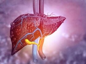 علائم کبد چرب چیست؟