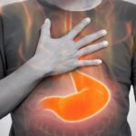 رفلاکس معده چیست و چگونه درمان می شود؟ | کدام غذاها باعث رفلاکس معده می شوند؟