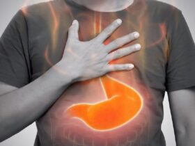 رفلاکس معده چیست و چگونه درمان می شود؟ | کدام غذاها باعث رفلاکس معده می شوند؟