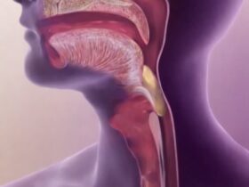 درمان اختلال بلع چیست؟