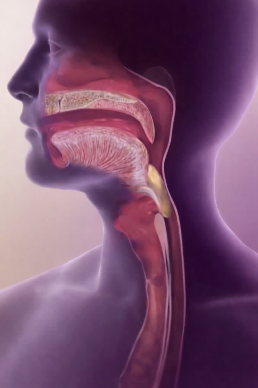 درمان اختلال بلع چیست؟