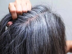 6 روش علمی برای به تاخیر انداختن سفیدی مو 3 6 روش علمی برای به تاخیر انداختن سفیدی مو