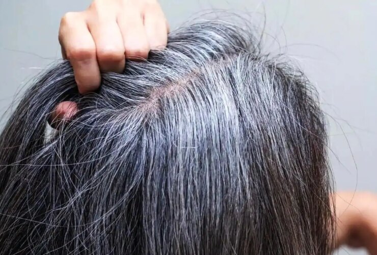 6 روش علمی برای به تاخیر انداختن سفیدی مو