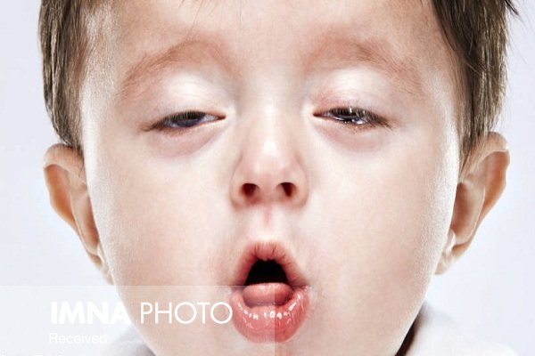 درد قفسه سینه و ذات الریه در کودکان 4 درد قفسه سینه و ذات الریه در کودکان