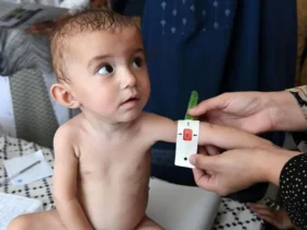 همه چیز در مورد یارانه کودکان بدغذا