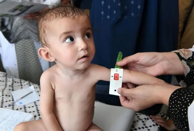 همه چیز در مورد یارانه کودکان بدغذا