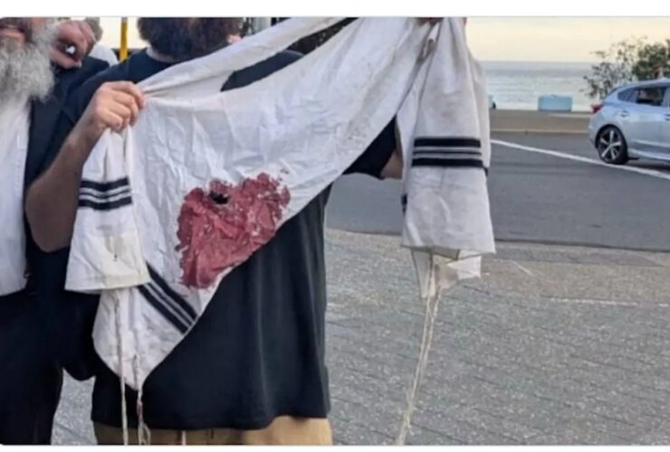 واکنش های بین المللی به حادثه استرالیا، از استارمر تا رئیس کمیسیون اروپا 20 واکنش های بین المللی به حادثه استرالیا، از استارمر تا رئیس کمیسیون اروپا