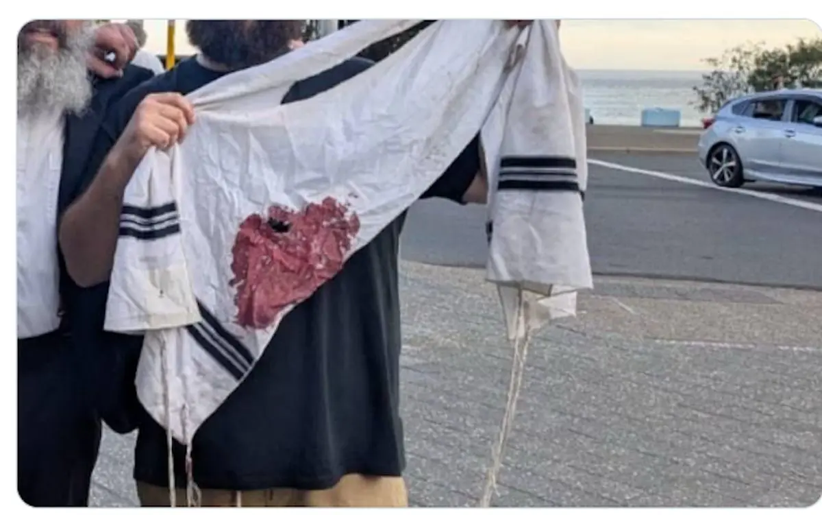 واکنش های بین المللی به حادثه استرالیا، از استارمر تا رئیس کمیسیون اروپا 1 واکنش های بین المللی به حادثه استرالیا، از استارمر تا رئیس کمیسیون اروپا