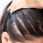 یک حقیقت وحشتناک؛ کمی استرس برای شروع ریزش مو کافی است