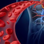 چه غذاهایی برای بهبود سلامت رگ های خونی مفید است؟