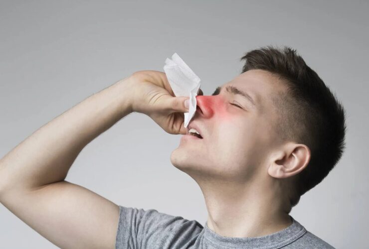 پاسخ به باورها و عادات غلط در مورد مراقبت از گوش و حلق و بینی هنگام خونریزی بینی چه کنیم؟ 3 پاسخ به باورها و عادات غلط در مورد مراقبت از گوش و حلق و بینی هنگام خونریزی بینی چه کنیم؟