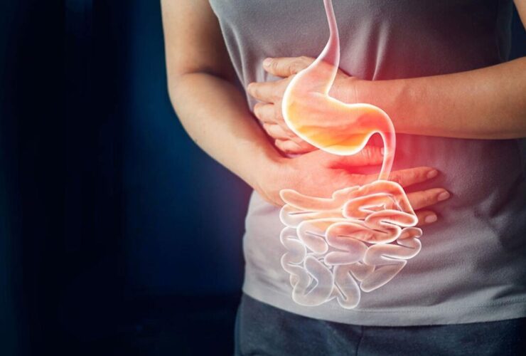 راه حل های تقویت کننده و تسکین دهنده التهاب و درمان رفلاکس معده دمنوش های طب سنتی معده