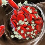 نتایج امیدوار کننده از استفاده از داروهای ضد انعقاد نسل جدید در کودکان