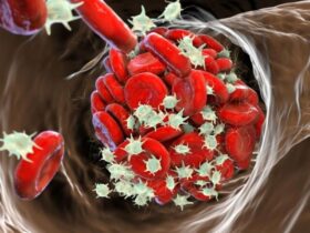 نتایج امیدوار کننده از استفاده از داروهای ضد انعقاد نسل جدید در کودکان