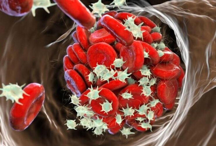 نتایج امیدوار کننده از استفاده از داروهای ضد انعقاد نسل جدید در کودکان 15 نتایج امیدوار کننده از استفاده از داروهای ضد انعقاد نسل جدید در کودکان