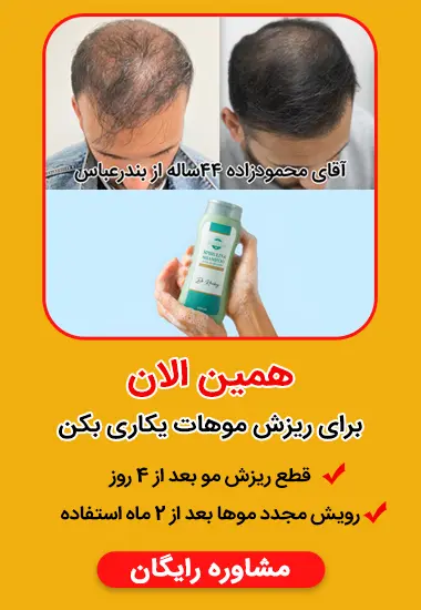 رویدادی که وقتی اتصال اینترنت محدود است توجه را به خود جلب می کند 17 بنر موبایل