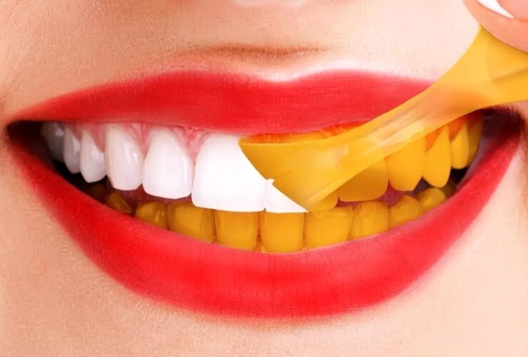 بعد از غذا خوردن چه چیزهایی را مسواک نزنیم؟