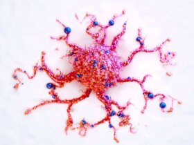 تشخیص زودهنگام سرطان با آزمایش ادرار خانگی 8 تشخیص زودهنگام سرطان با آزمایش ادرار خانگی