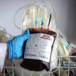 کاهش عوارض انتقال خون از طریق ایجاد خون فقیر از لکوسیت / پیشرفت در سازمان انتقال خون پس از انقلاب