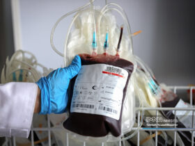 کاهش عوارض انتقال خون از طریق ایجاد خون فقیر از لکوسیت / پیشرفت در سازمان انتقال خون پس از انقلاب