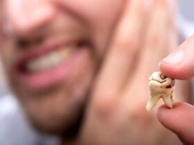 پنج اشتباه رایج در مراقبت از دندان