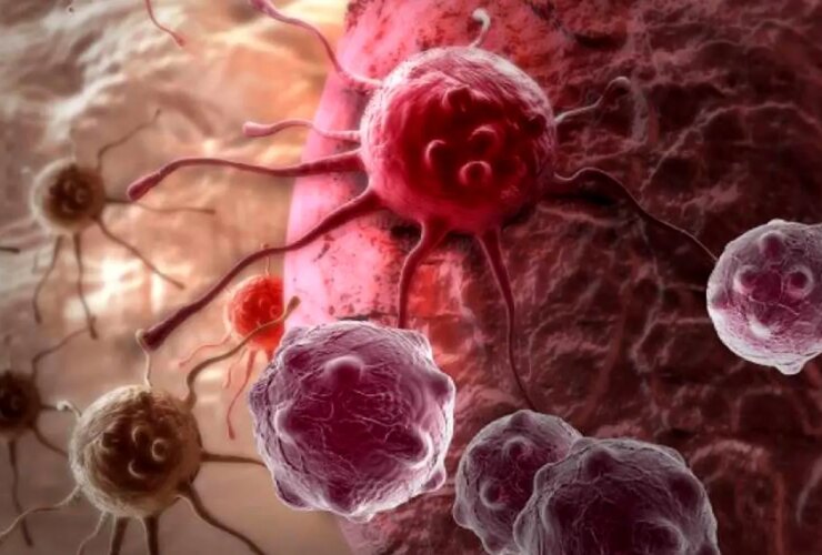 هر 5 دقیقه یک ایرانی به سرطان مبتلا می شود 25 هر 5 دقیقه یک ایرانی به سرطان مبتلا می شود