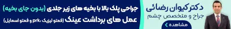دکتر Keyvan Rızaei - تصادفی
