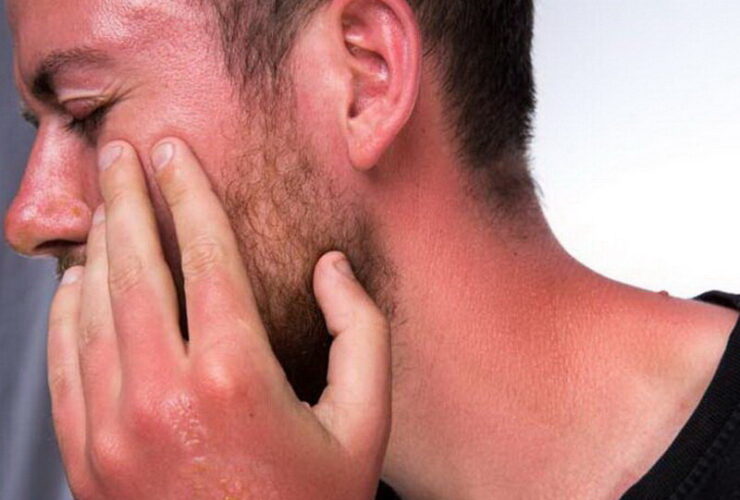 ضد آفتاب مناسب چه ویژگی هایی دارد؟