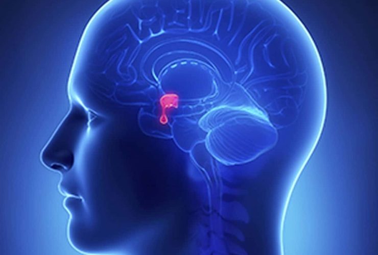 اختلالات هیپوفیز چگونه تعریف می شوند؟ علائم خطرناک ناشی