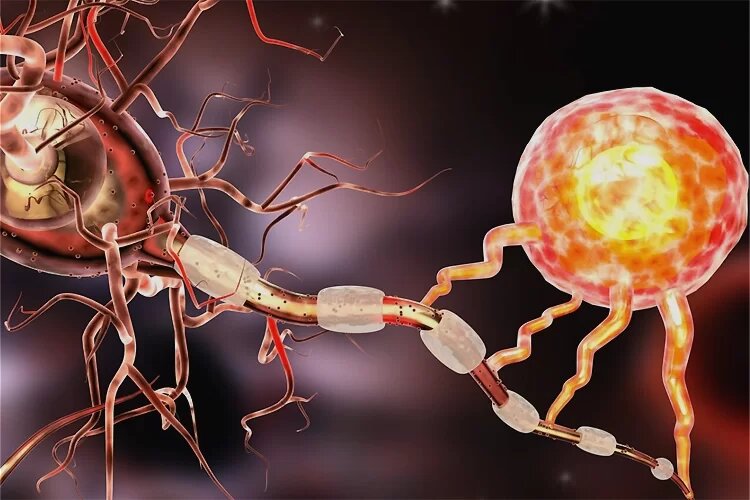 از تکرار و فروپاشی تا پیشرفت خاموش؛ چگونه ام اس تغییر شکل می دهد؟