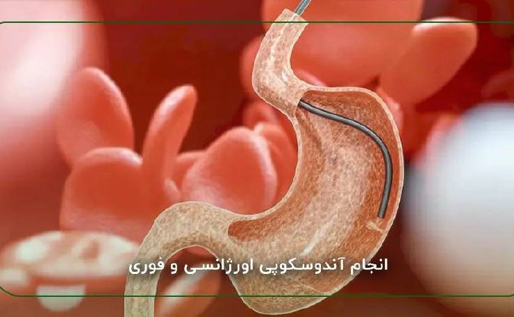 نقش اندوسکوپی در تشخیص و درمان زخم های گوارشی 3 d53e1b29 46d5 4926 b549 ee19f2b6c4e5