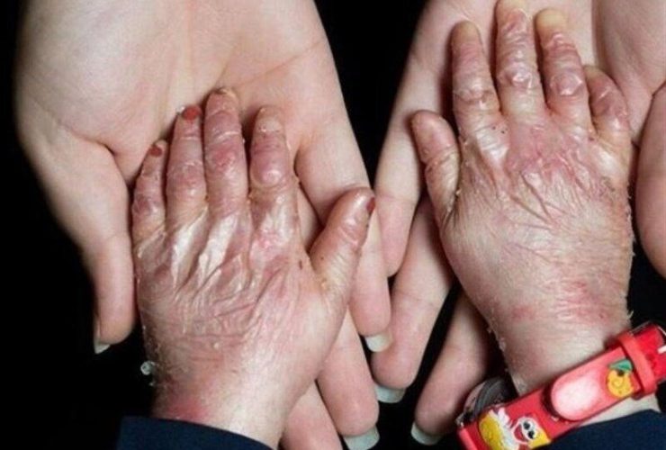 بیماران دارای مجوز تحت پوشش خدمات دندانپزشکی رایگان هستند